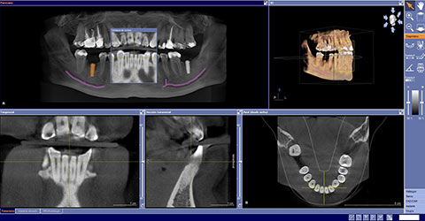 TAC Clínica Dental Ursua Berrazueta